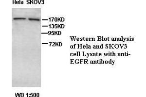 Image no. 1 for anti-Epidermal Growth Factor Receptor (EGFR) antibody (ABIN791216) (EGFR anticorps)