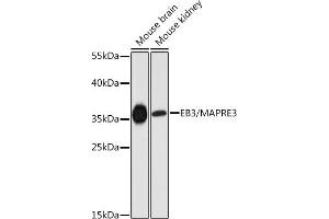 Western blot analysis of extracts of various cell lines, using EB3/EB3/M antibody (ABIN6130540, ABIN6143547, ABIN6143548 and ABIN6225046) at 1:3000 dilution. (MAPRE3 anticorps  (AA 1-281))