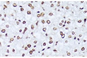 Immunohistochemistry of paraffin-embedded Mouse liver using Phospho-ABL1(Y245) Polyclonal Antibody at dilution of 1:100 (40x lens). (ABL1 anticorps  (pTyr245))