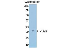Western Blotting (WB) image for anti-Tumor Protein, Translationally-Controlled 1 (TPT1) (AA 1-172) antibody (ABIN1176579)