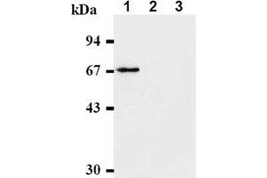 Western Blotting (WB) image for anti-Checkpoint Kinase 2 (CHEK2) antibody (ABIN487312) (CHEK2 anticorps)