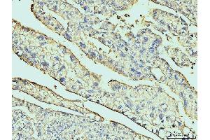 IHC analysis of Annexin VI using anti-Annexin VI antibody (ABIN7601597).