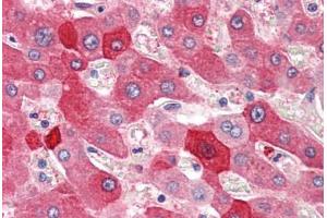 Human Liver (formalin-fixed, paraffin-embedded) stained with MYO5B antibody ABIN396915 at 20 ug/ml followed by biotinylated goat anti-rabbit IgG secondary antibody ABIN481713, alkaline phosphatase-streptavidin and chromogen. (MYO5B anticorps  (C-Term))