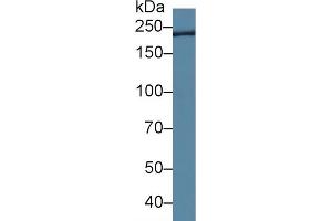 Detection of TCHH in Rat Tongue lysate using Polyclonal Antibody to Trichohyalin (TCHH) (Trichohyalin anticorps  (AA 1851-1943))