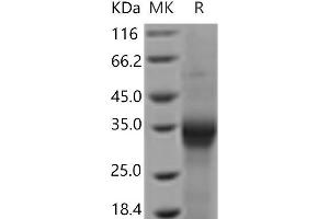 Western Blotting (WB) image for Interleukin 20 Receptor beta (IL20RB) protein (His tag) (ABIN7321246)