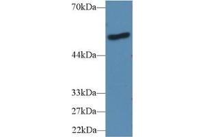 Detection of LBP in Human A431 cell lysate using Polyclonal Antibody to Lipopolysaccharide Binding Protein (LBP) (LBP anticorps  (AA 25-481))