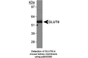 Image no. 1 for anti-Solute Carrier Family 2 (Facilitated Glucose Transporter), Member 9 (SLC2A9) (AA 400-450) antibody (ABIN363669) (SLC2A9 anticorps  (AA 400-450))