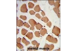 Formalin-fixed and paraffin-embedded human skeletal muscle reacted with PHYH2 Antibody (C-term), which was peroxidase-conjugated to the secondary antibody, followed by DAB staining. (HACL1 anticorps  (C-Term))