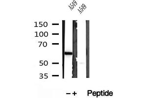Western blot analysis of extracts of A549 cells, using PFKFB3-Specific antibody. (PFKFB3 anticorps  (C-Term))