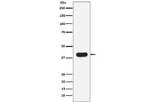 Western blot analysis of HLA B7 expression in Ramos cell lysate.