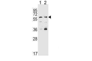 Western Blotting (WB) image for anti-Solute Carrier Family 22 Member 4 (SLC22A4) antibody (ABIN3002503) (SLC22A4 anticorps)