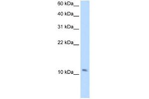 WB Suggested Anti-SMPX Antibody Titration:  2.
