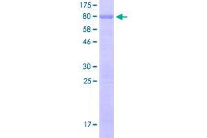Image no. 1 for Sp7 Transcription Factor (SP7) (AA 1-431) protein (GST tag) (ABIN1321041)