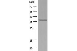 Western Blotting (WB) image for Guanosine Monophosphate Reductase 2 (GMPR2) (AA 1-348) protein (His-IF2DI Tag) (ABIN7123244)