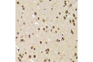 Immunohistochemistry of paraffin-embedded rat brain using SNRPA Antibody. (SNRPA1 anticorps  (AA 1-282))