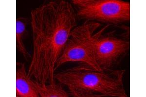 Immunocytochemistry (ICC) image for anti-alpha Tubulin (TUBA1) (AA 443-449) antibody (ABIN1742552)