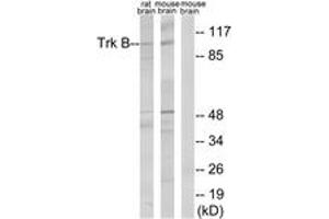 Western blot analysis of extracts from rat brain/mouse brain cells, treated with PBS 60', using Trk B (Ab-515) Antibody.