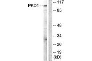 Western blot analysis of extracts from HuvEc cells, treated with PMA 125ng/ml 30', using PKD1/PKC mu (Ab-205) Antibody.