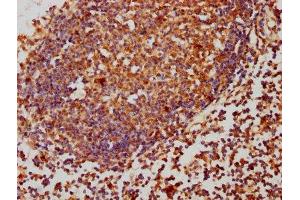 IHC image of ABIN7169270 diluted at 1:260 and staining in paraffin-embedded human lymph node tissue performed on a Leica BondTM system.