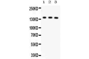 Western Blot of Anti-ABCB11 Antibody.