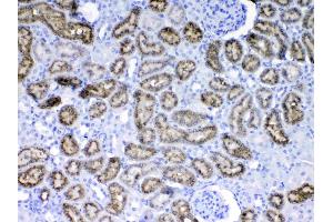IHC analysis of RBP4 using anti-RBP4 antibody .