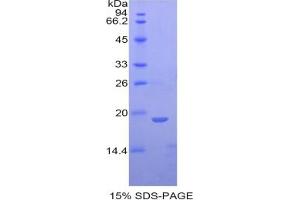 SDS-PAGE of Protein Standard from the Kit (Highly purified E.