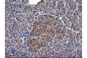 Image no. 14 for anti-Tubulin, alpha-Like 3 (TUBAL3) (AA 150-446) antibody (ABIN1490956)