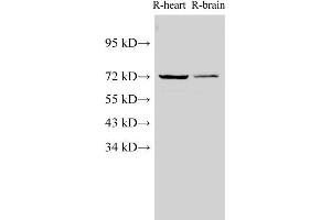 Western Blot analysis of Rat heart and Rat brain using Lamin B1 Polyclonal Antibody at dilution of 1:1000 (Lamin B1 anticorps)