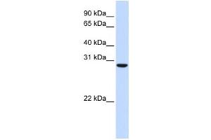 Western Blotting (WB) image for anti-Chromosome 18 Open Reading Frame 10 (C18orf10) antibody (ABIN2459873) (TPGS2 anticorps)