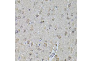 Immunohistochemistry of paraffin-embedded mouse brain using NME1 Antibody (ABIN5970089) at dilution of 1/200 (40x lens). (NME1 anticorps  (C-Term))