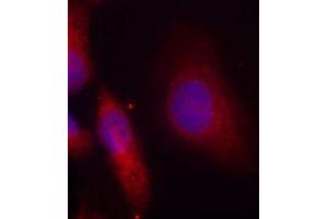 Immunofluorescence staining of methanol-fixed HeLa cells using Phospho-SRC-Y529 antibody (ABIN5969948). (Src anticorps  (pTyr529))