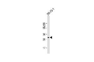 Anti-MYOGENIN Antibody (N-term) at 1:1000 dilution + ZR-75-1 whole cell lysate Lysates/proteins at 20 μg per lane. (Myogenin anticorps  (N-Term))