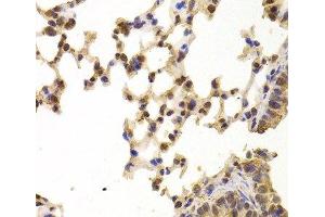 Immunohistochemistry of paraffin-embedded Mouse lung using PPP2R1B Polyclonal Antibody at dilution of 1:100 (40x lens). (PPP2R1B anticorps)