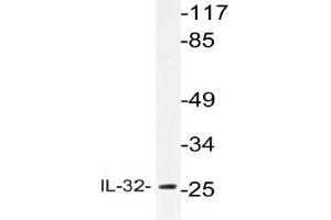 Western blot (WB) analyzes of IL-32 antibody in extracts from HepG2 cells.
