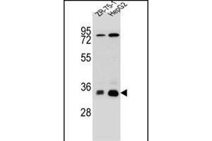 MTHFD2L Antibody (C-term) (ABIN655253 and ABIN2844851) western blot analysis in HepG2,ZR-75-1 cell line lysates (35 μg/lane). (MTHFD2L anticorps  (C-Term))