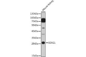Western blot analysis of extracts of Mouse kidney cells, using SOX21 antibody (ABIN7270574) at 1:1000 dilution. (SOX21 anticorps  (AA 167-276))