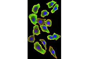 Immunocytochemistry (ICC) image for anti-TNF Receptor-Associated Factor 2 (TRAF2) (AA 39-188) antibody (ABIN5896378) (TRAF2 anticorps  (AA 39-188))