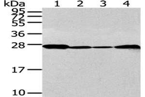 Gel: 12 % SDS-PAGE, Lysate: 40 μg, Lane 1-4: 293T, K562, Jurkat and 231 cell, Primary antibody: ABIN7128063(UCHL3 Antibody) at dilution 1/300 dilution, Secondary antibody: Goat anti rabbit IgG at 1/8000 dilution, Exposure time: 30 seconds (UCHL3 anticorps)