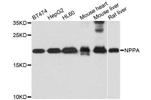 Western blot analysis of extracts of various cell lines, using NPPA antibody.