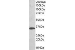 Western Blotting (WB) image for anti-Thioredoxin-Related Transmembrane Protein 1 (TMX1) (C-Term) antibody (ABIN2466410) (TMX1 anticorps  (C-Term))