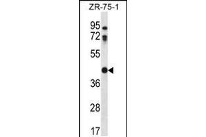 Western blot analysis in ZR-75-1 cell line lysates (35ug/lane). (CTSO anticorps  (N-Term))