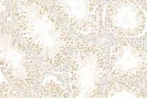 Immunohistochemistry analysis of paraffin-embedded mouse tumor using,MOG (ABIN7075362) at dilution of 1: 1500