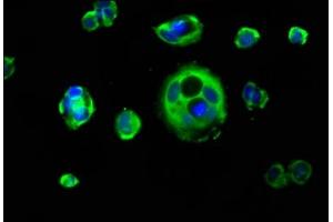 anti-Keratin 1 (KRT1) (AA 267-438) antibody