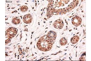 Image no. 13 for anti-Myc Proto-Oncogene protein (MYC) antibody (ABIN1497012) (c-MYC anticorps)