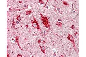 Anti-RASD2 / RHES / DEXRAS1 antibody IHC staining of human brain, cortex.