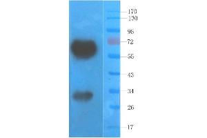 Western Blot using anti-VEGF antibody  Rat skin lysate was resolved on a 10% SDS PAGE gel and blots probed with  at 1. (Recombinant VEGF anticorps)