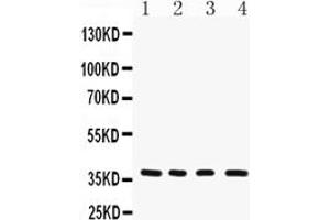 Western blot analysis of MTCO1 using anti-MTCO1 antibody (ABIN3042632).