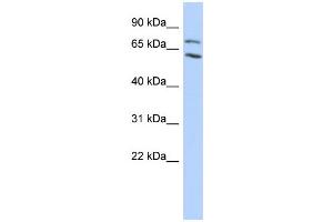 WB Suggested Anti-MTA2 Antibody Titration:  0. (MTA2 anticorps  (N-Term))