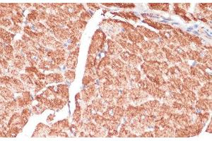 Immunohistochemistry of paraffin-embedded Mouse heart using DES Polyclonal Antibody at dilution of 1:100 (40x lens). (Desmin anticorps)