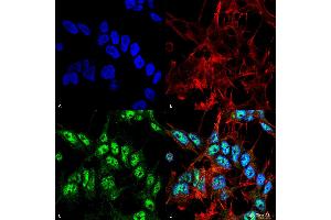 Immunocytochemistry/Immunofluorescence analysis using Rabbit Anti-Beclin 1 Polyclonal Antibody . (Beclin 1 anticorps)